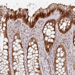 Anti-CA7 antibody produced in rabbit 