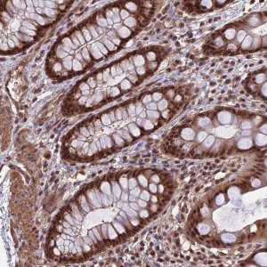 Anti-CABIN1 antibody produced in rabbit 