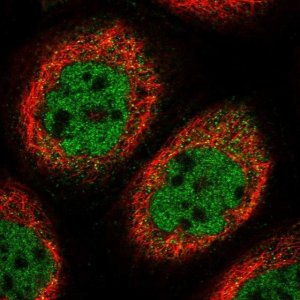 Anti-CABIN1 antibody produced in rabbit 