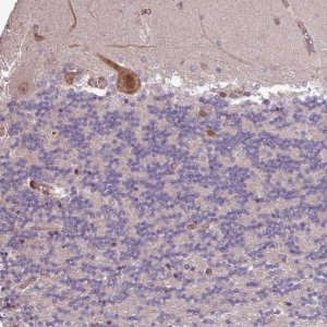 Anti-CABP1 antibody produced in rabbit 
