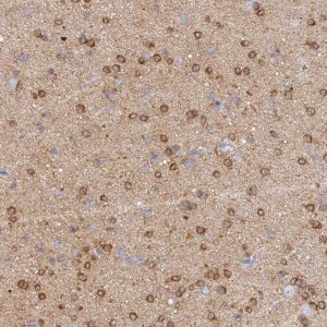 Anti-CACNA1B antibody produced in rabbit 
