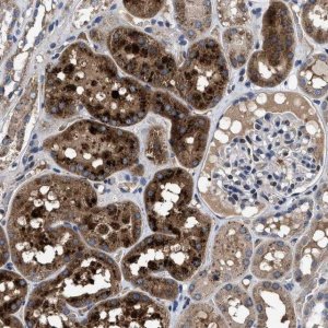 Anti-CACNA1D antibody produced in rabbit 