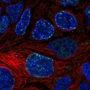 Anti-CACNA1D antibody produced in rabbit 