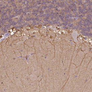 Anti-CACNB1 antibody produced in rabbit 