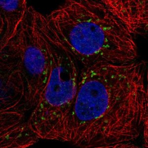 Anti-CACNB3 antibody produced in rabbit 