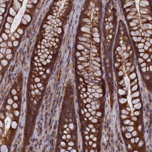 Anti-CACTIN antibody produced in rabbit 