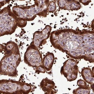 Anti-CARHSP1 antibody produced in rabbit HPA051911-100UL