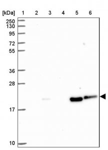 Anti-CARHSP1 antibody produced in rabbit HPA051911-100UL