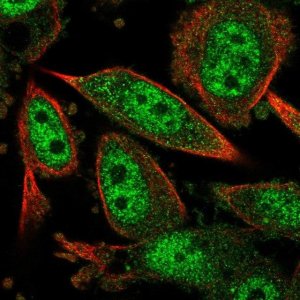 Anti-CARM1 antibody produced in rabbit 