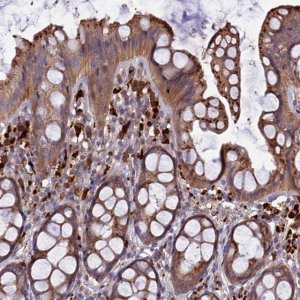 Anti-CARMIL2 antibody produced in rabbit 