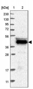 Anti-CARNMT1 antibody produced in rabbit 