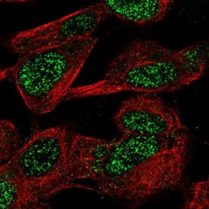 Anti-CASC10 antibody produced in rabbit 