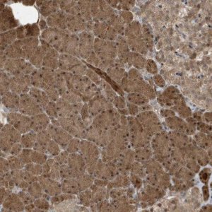 Anti-CATSPERB antibody produced in rabbit 