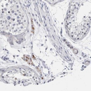 Anti-CATSPERD antibody produced in rabbit 