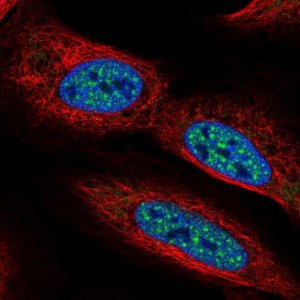 Anti-CBFA2T2 antibody produced in rabbit 