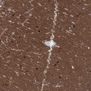 Anti-CBLN3 antibody produced in rabbit HPA041266-100UL