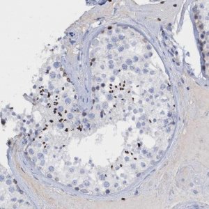 Anti-CBX2 antibody produced in rabbit 