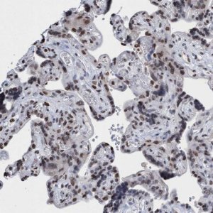 Anti-CBX2 antibody produced in rabbit 