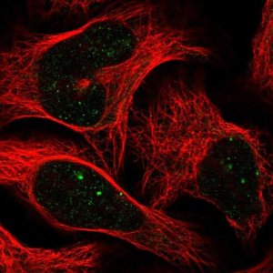 Anti-CBX4 antibody produced in rabbit 