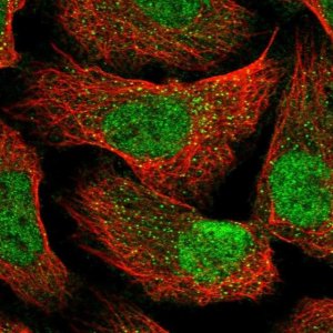 Anti-CC2D1B antibody produced in rabbit 