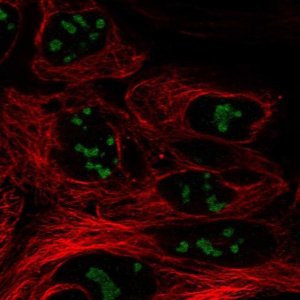 Anti-CC2D2B antibody produced in rabbit 
