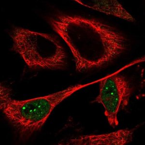 Anti-CCDC102A antibody produced in rabbit 