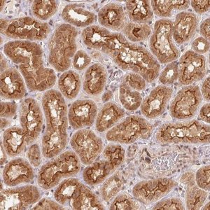 Anti-CCDC102B antibody produced in rabbit 