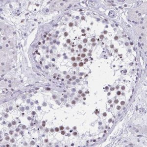 Anti-CCDC105 antibody produced in rabbit 