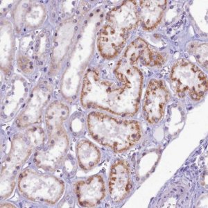 Anti-CCDC106 antibody produced in rabbit 