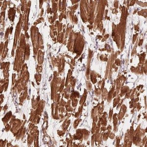 Anti-CCDC112 antibody produced in rabbit 