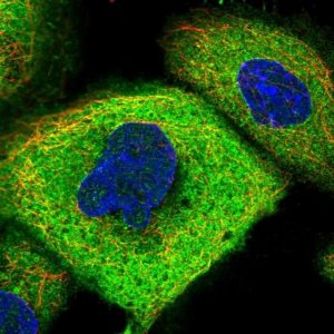 Anti-CCDC112 antibody produced in rabbit 