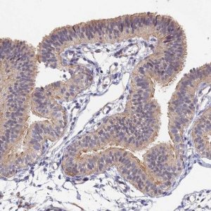 Anti-CCDC113 antibody produced in rabbit HPA040759-100UL