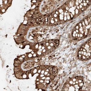 Anti-CCDC115 antibody produced in rabbit 