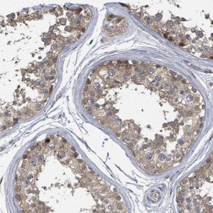 Anti-CCDC121 antibody produced in rabbit 