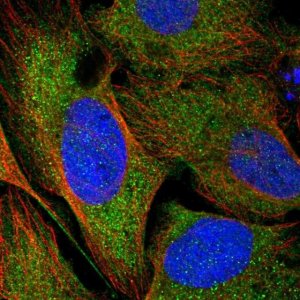 Anti-CCDC121 antibody produced in rabbit 
