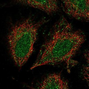 Anti-CCDC122 antibody produced in rabbit 