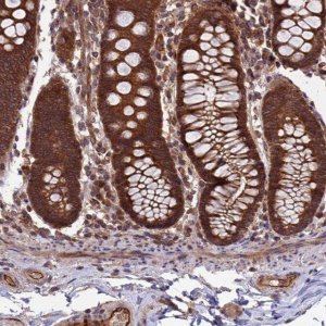 Anti-CCDC125 antibody produced in rabbit 