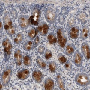 Anti-CCDC126 antibody produced in rabbit 