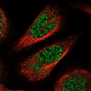 Anti-CCDC126 antibody produced in rabbit 