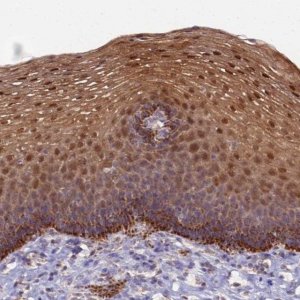 Anti-CCDC127 antibody produced in rabbit 