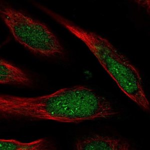 Anti-CCDC127 antibody produced in rabbit 