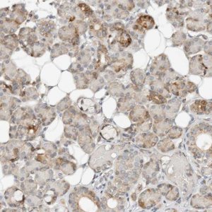 Anti-CCDC129 antibody produced in rabbit 