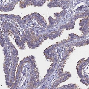 Anti-CCDC13 antibody produced in rabbit 