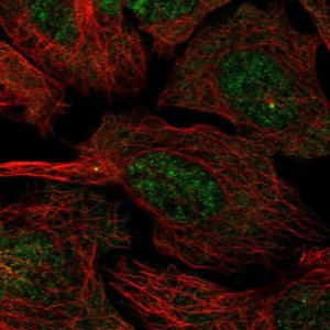 Anti-CCDC13 antibody produced in rabbit 