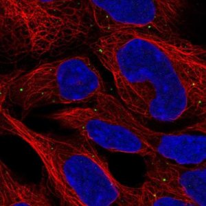 Anti-CCDC130 antibody produced in rabbit 