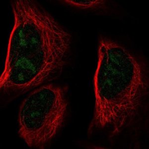Anti-CCDC137 antibody produced in rabbit 