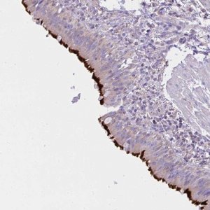 Anti-CCDC142 antibody produced in rabbit 