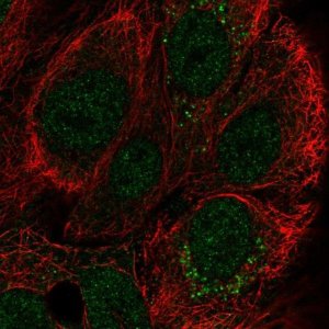 Anti-CCDC144A antibody produced in rabbit 