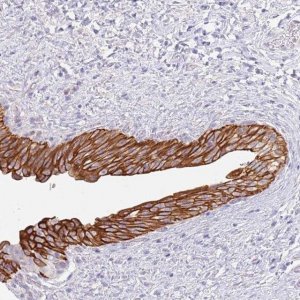 Anti-CCDC149 antibody produced in rabbit 