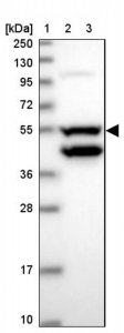 Anti-CCDC149 antibody produced in rabbit 